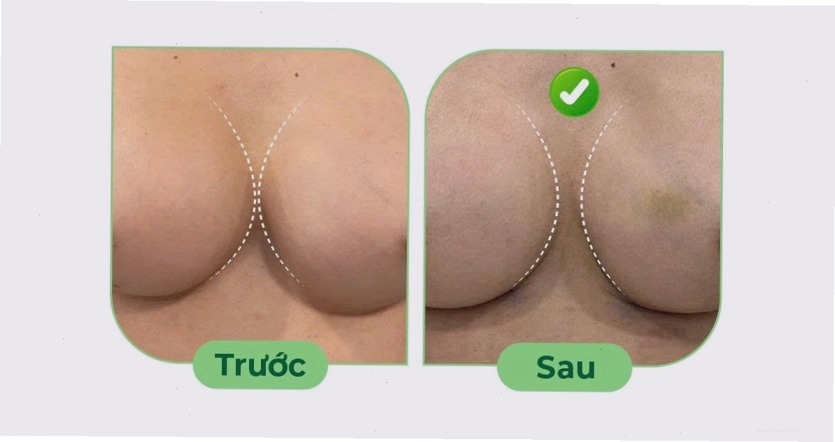 Ảnh minh họa người phụ nữ chọn áo ngực phù hợp