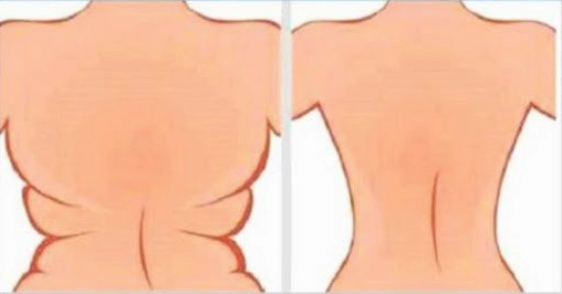 Bài tập giảm mỡ lưng vai cho nữ hiệu quả tại nhà