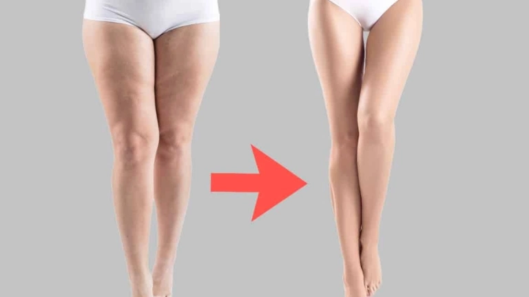Bài tập làm nhỏ bắp chân hiệu quả tại nhà