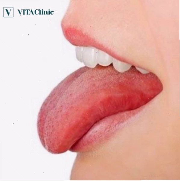 Bài tập nâng gò má giúp khuôn mặt thon gọn
