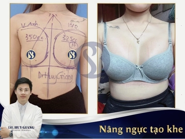 Bảng xếp hạng cỡ ngực trung bình của phụ nữ các nước trên thế giới
