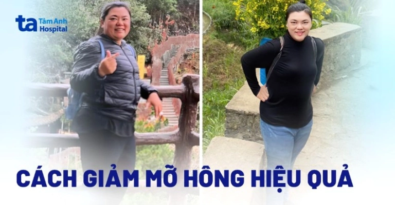 Bí quyết giảm mỡ 2 bên eo hiệu quả, lấy lại vóc dáng cân đối