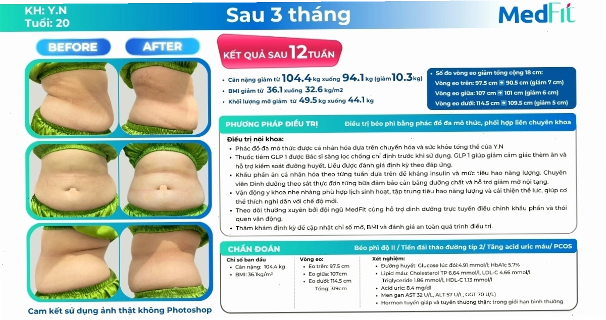 Biểu đồ minh họa ca lâm sàng giảm cân thành công sau 12 tuần