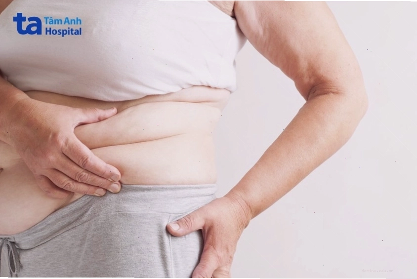 Bụng mẹ sau sinh cần thời gian để phục hồi và săn chắc trở lại