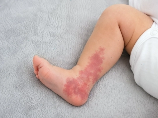 Các phương pháp giảm béo an toàn và hiệu quả