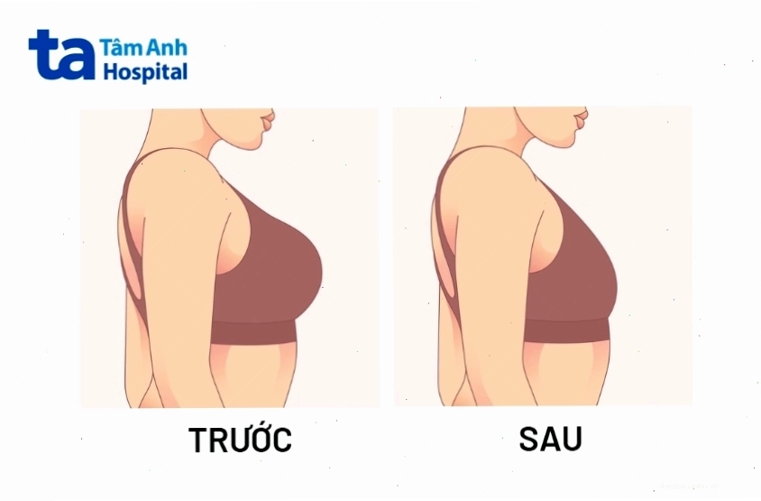 Chế độ ăn uống lành mạnh giúp thu nhỏ vòng 1 tự nhiên