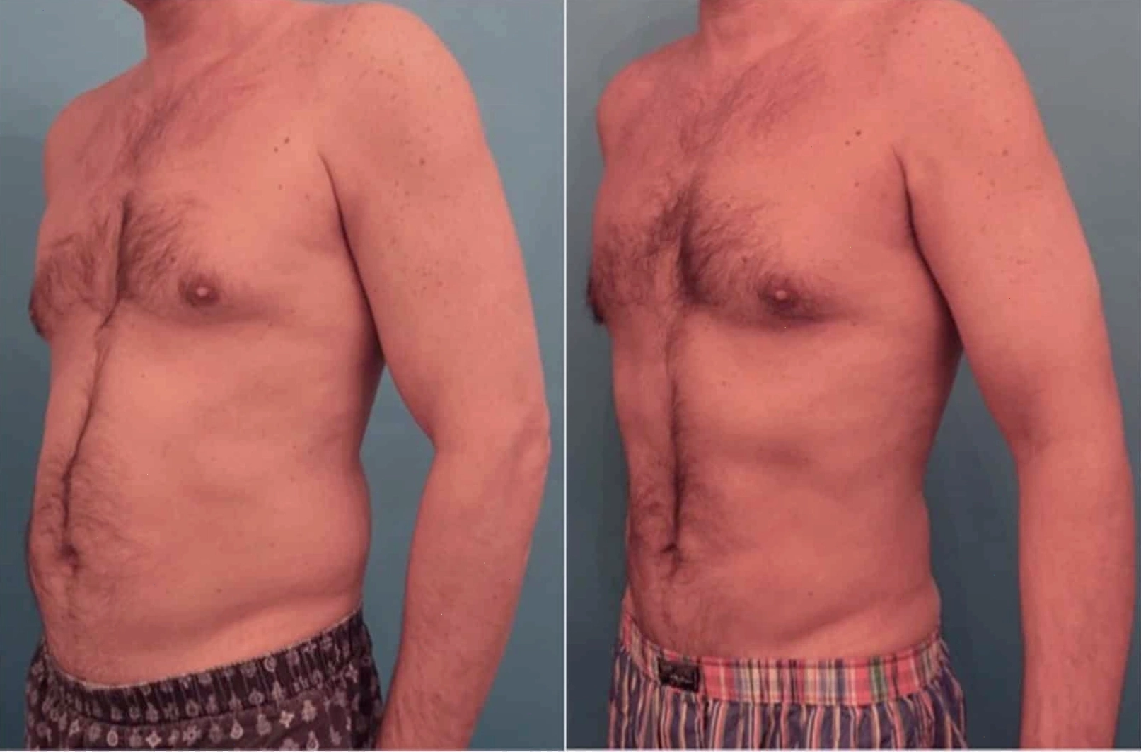 Chuyên gia tư vấn về liệu trình body contouring