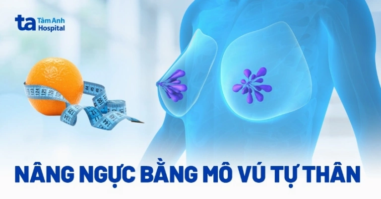 Công nghệ nâng ngực không phẫu thuật: Giải pháp thẩm mỹ tiên tiến 2026