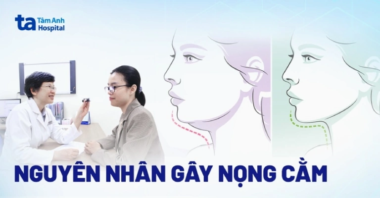 Giảm Nọng Cằm Cấp Tốc: Nguyên Nhân, Dấu Hiệu Và Giải Pháp Hiệu Quả 2026