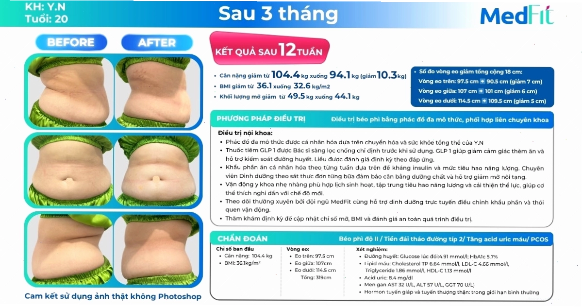 Hình ảnh minh họa ca lâm sàng giảm cân thành công sau 12 tuần