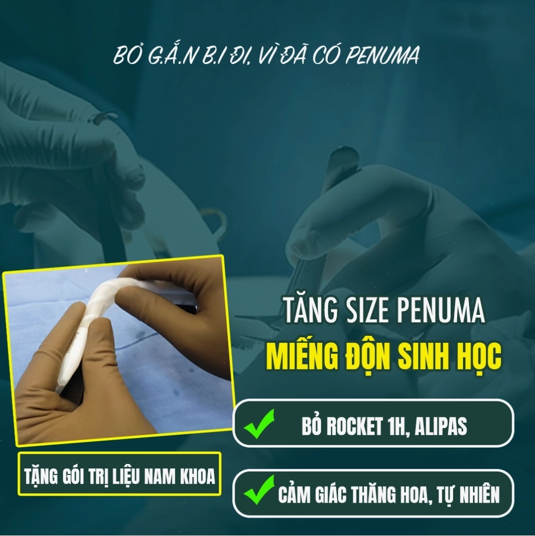 Hình ảnh minh họa các dụng cụ hỗ trợ mẹ cho con bú như máy hút sữa và kem dưỡng núm vú