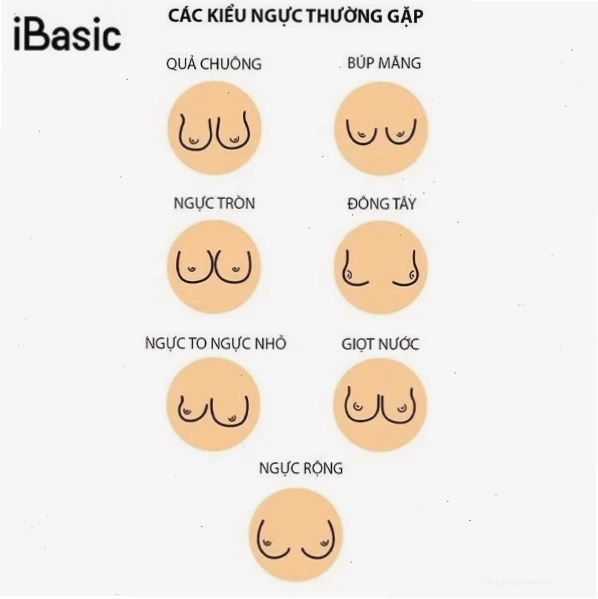 Hình ảnh minh họa dáng ngực đông tây với khoảng cách giữa hai bầu ngực