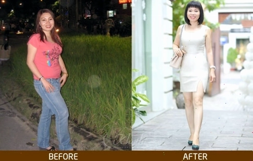 Hình ảnh minh họa hiệu quả của liệu trình D-Otesalycool II