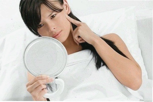Hình ảnh minh họa nám da ở phụ nữ mang thai