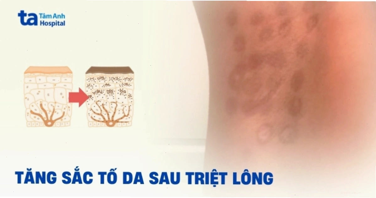 Hình ảnh minh họa nhiều người ở các độ tuổi khác nhau có thể bị nọng cằm