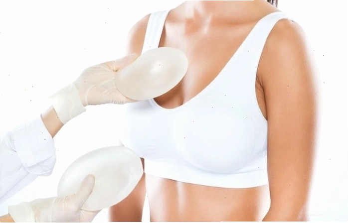 Kế hoạch nâng ngực chi tiết giúp đạt được kết quả như ý