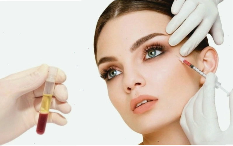Kết hợp lăn kim và tiêm huyết tương giàu PRP giúp xóa đường rãnh lệ và cải thiện quầng thâm mắt hiệu quả