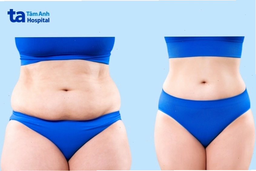 Lợi ích của việc giảm cân sau sinh đối với sức khỏe mẹ bỉm