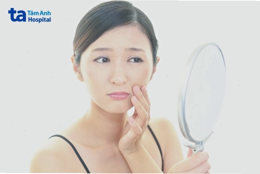 Minh họa các nguyên nhân gây xuất hiện rãnh cười trên khuôn mặt