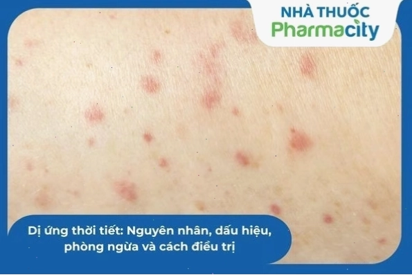 Minh họa tư thế mewing đúng cách