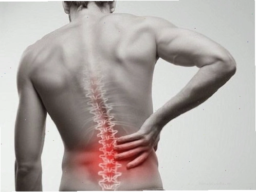 Một số người tập tạ có thể gặp tình trạng bệnh lý thoát vị đĩa đệm