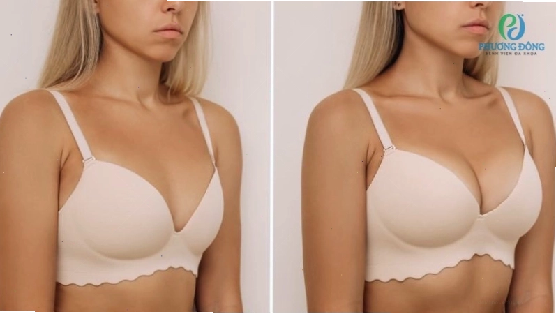 Nâng ngực không can thiệp ngoại khoa có khả năng làm vòng 1 tròn đầy tức thì