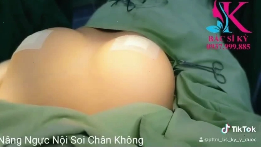 Ngực căng tròn, khe ngực sexy giúp tự tin mặc bikini