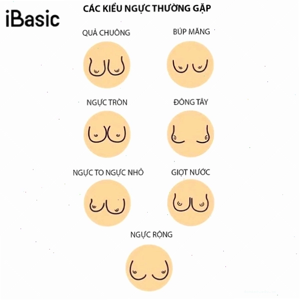 Ngực đông tây với hai bầu ngực cách xa