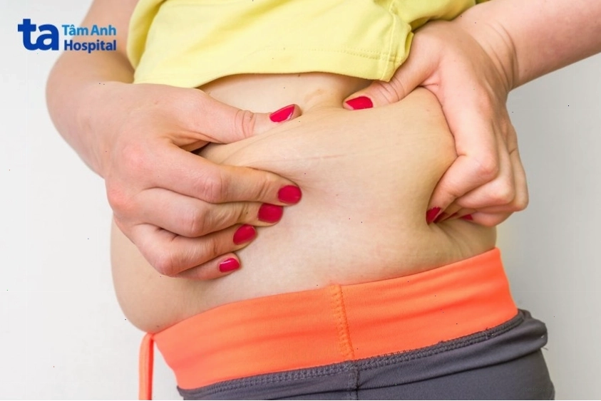 Nhiều nguyên nhân dẫn đến tích mỡ ở hai bên hông
