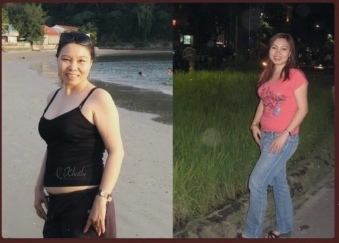 Nữ doanh nhân Tina Thủy trước và sau khi điều trị công nghệ D-Otesalycool II