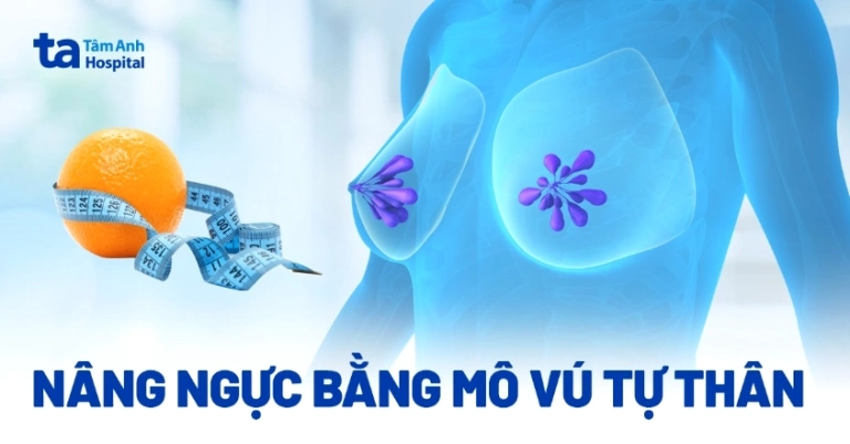 Phẫu thuật nâng ngực bằng bơm ngực silicon: Lợi ích và rủi ro