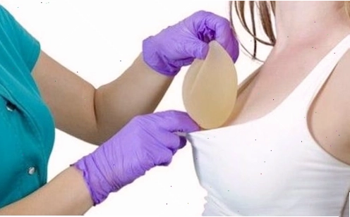 Phẫu thuật nâng vòng 1 là nhu cầu của rất nhiều người hiện nay
