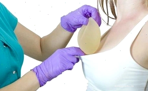 Phẫu thuật nâng vòng 1 là nhu cầu làm đẹp phổ biến của nhiều phụ nữ