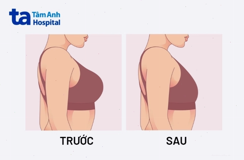 Phụ nữ tập thể dục để thu nhỏ vòng 1