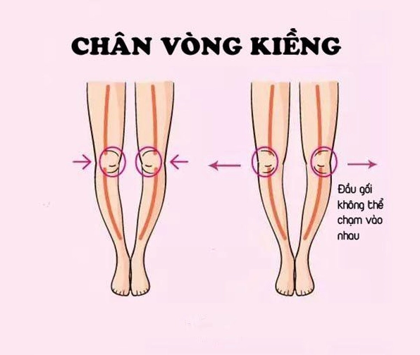 Pilates cho chân vòng kiềng cải thiện dáng chân hiệu quả