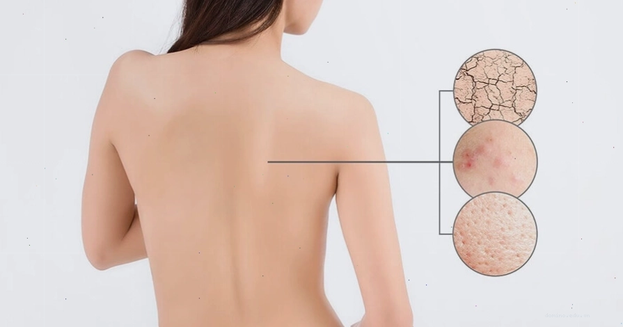 Tẩy tế bào chết giúp ngăn ngừa các bệnh lý về da