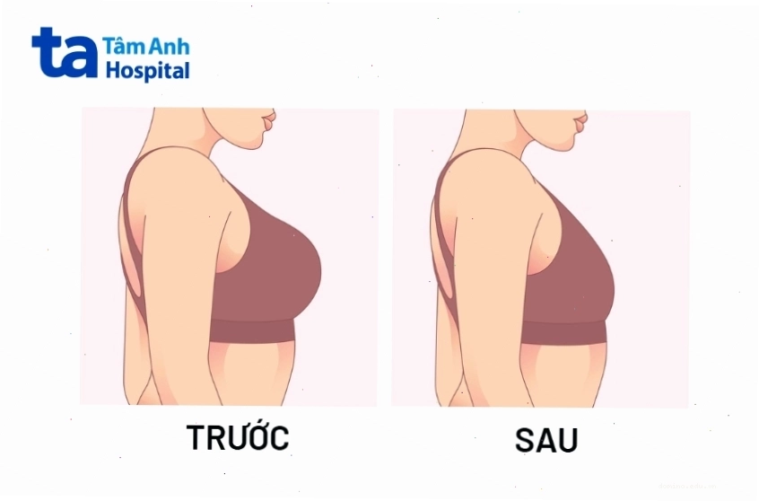 Thực đơn lành mạnh giúp giảm vòng 1 tự nhiên