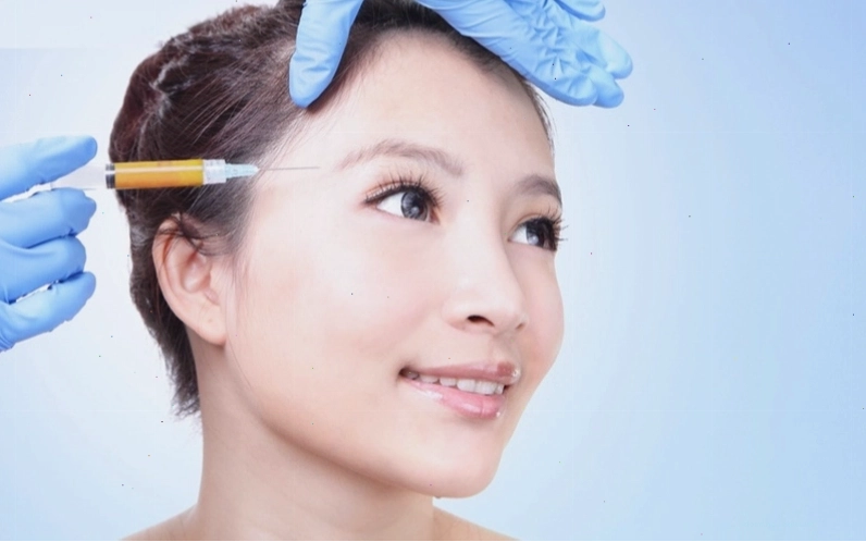 Tiêm mỡ tự thân làm đầy hốc mắt, đường rãnh lệ là kỹ thuật xóa rãnh nước mắt hiệu quả