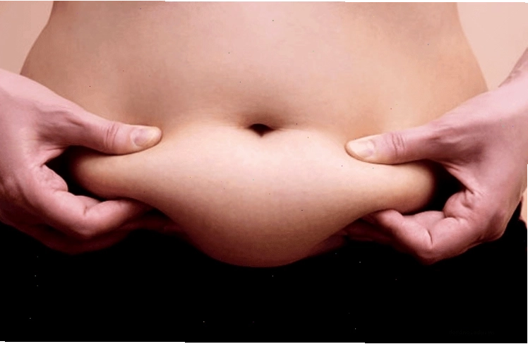 Tình trạng béo phì và thừa cân do tích mỡ quá mức