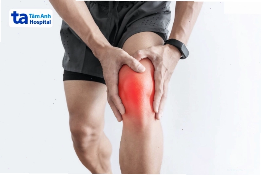 Viêm khớp gối gây đau, sưng và cứng khớp, ảnh hưởng đến khả năng vận động.